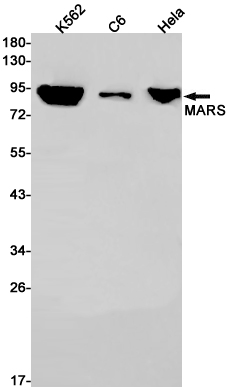MetRS Rabbit mAb
