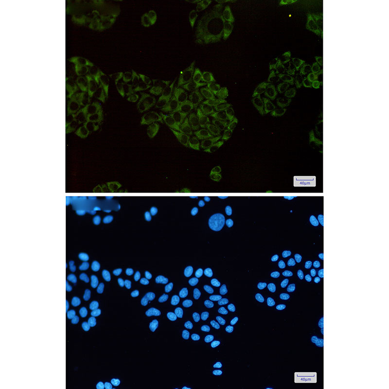 MEKK2 Rabbit mAb