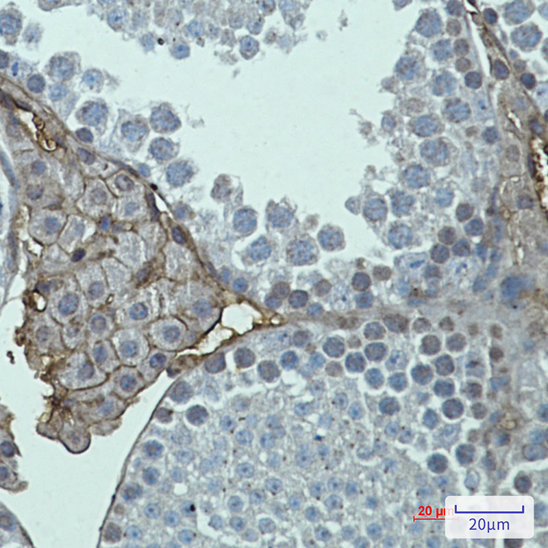 Metabotropic Glutamate Receptor 2 Rabbit mAb