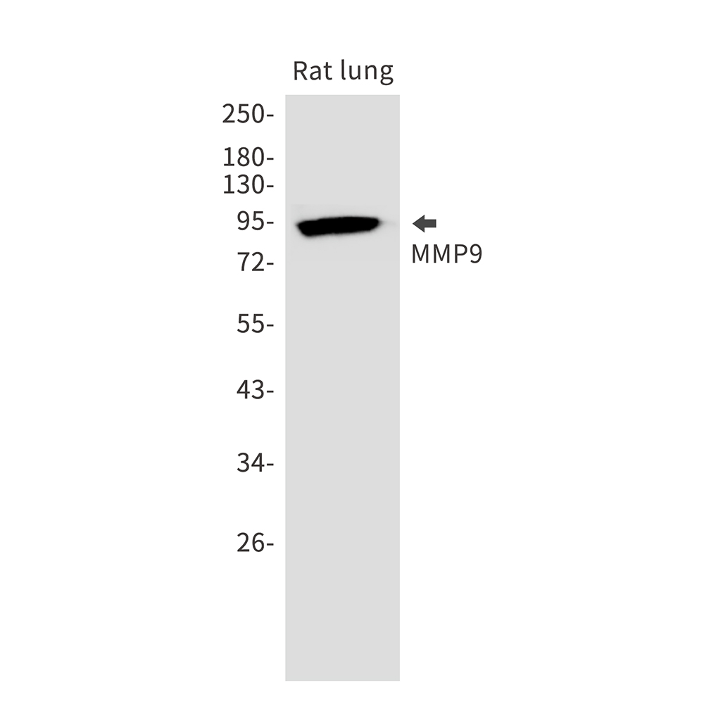 MMP9 Rabbit mAb