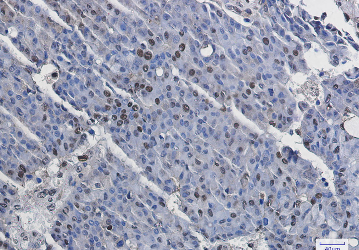 Phospho-MSK1 (Ser376) Rabbit mAb