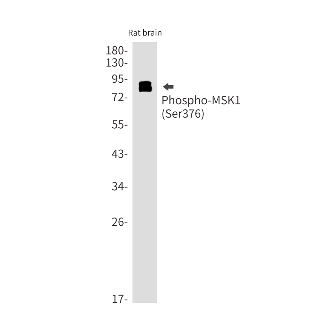 Phospho-MSK1 (Ser376) Rabbit mAb
