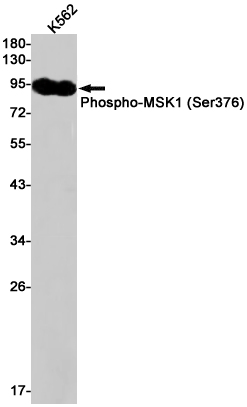 Phospho-MSK1 (Ser376) Rabbit mAb