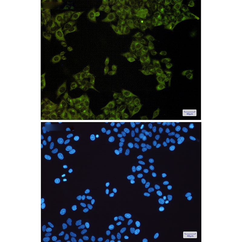 MST4 Rabbit mAb