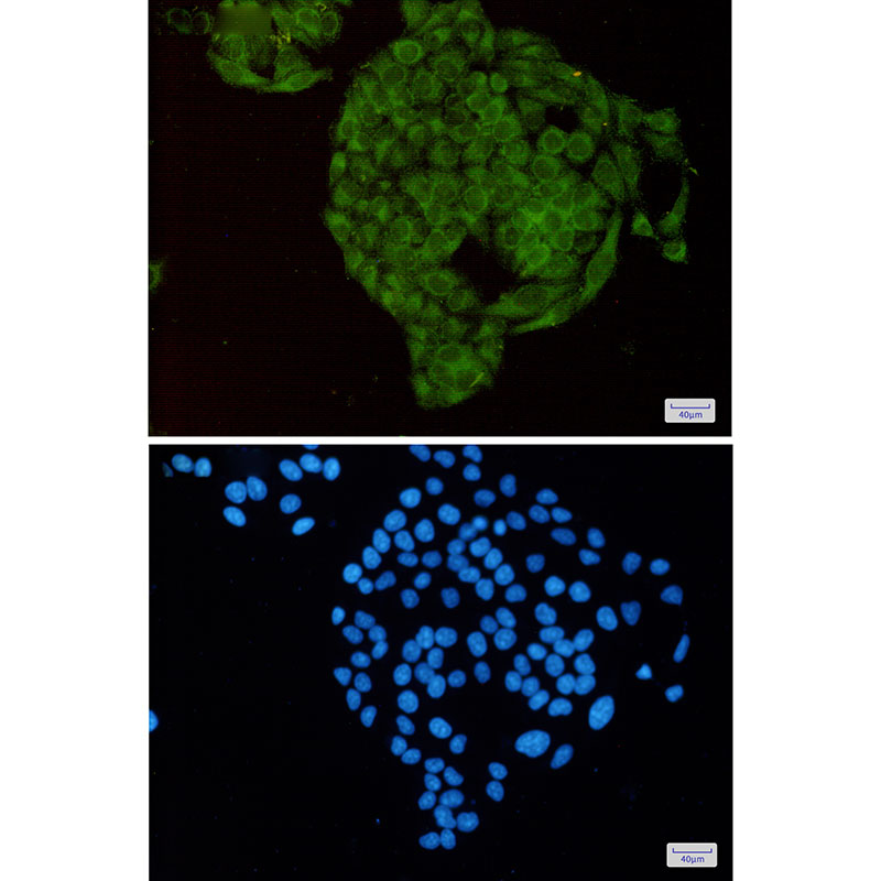 MTH1 Rabbit mAb