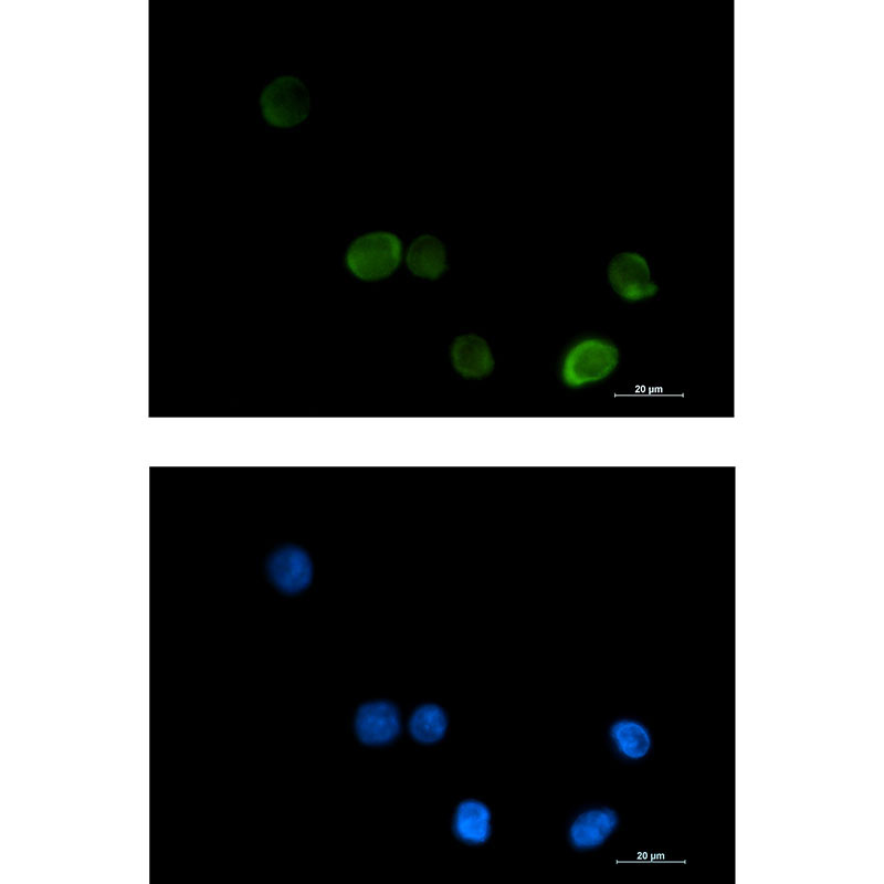 MTHFR Rabbit mAb