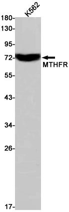 MTHFR Rabbit mAb