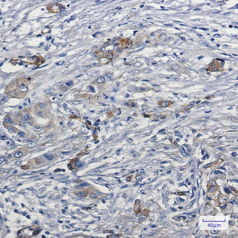 MYO1B Rabbit mAb