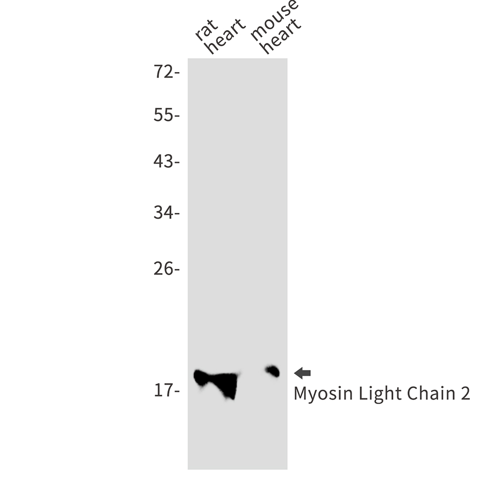 MYL2 Rabbit mAb