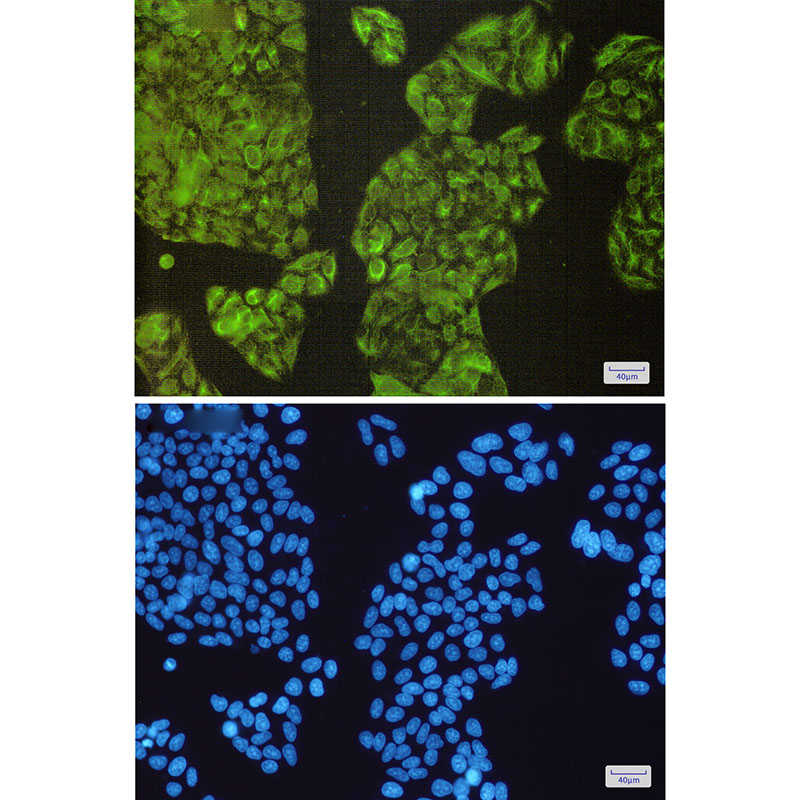NCK2 Rabbit mAb