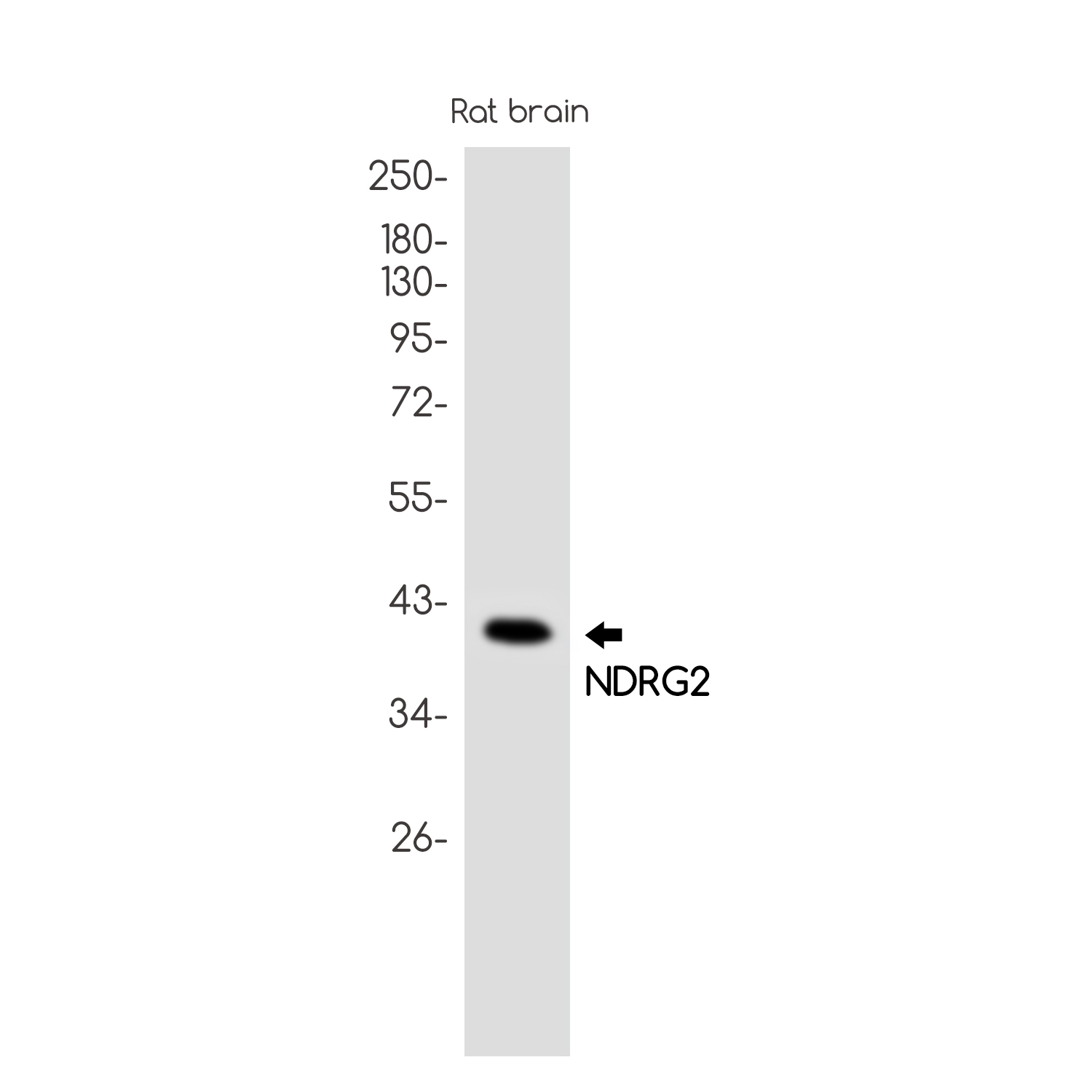 NDRG2 Rabbit mAb