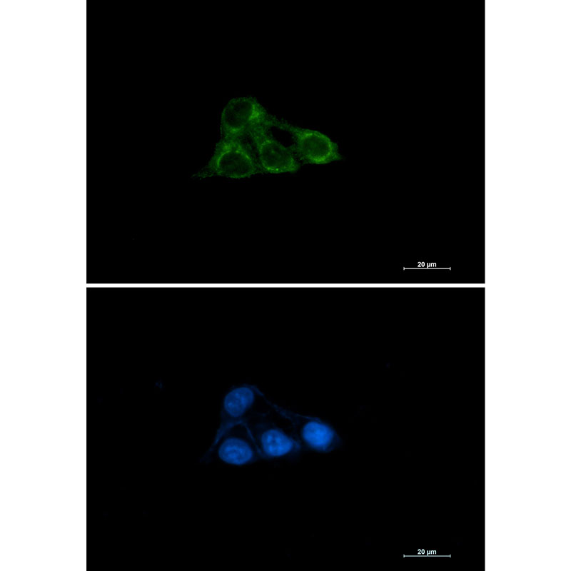 NDUFAF4 Rabbit mAb
