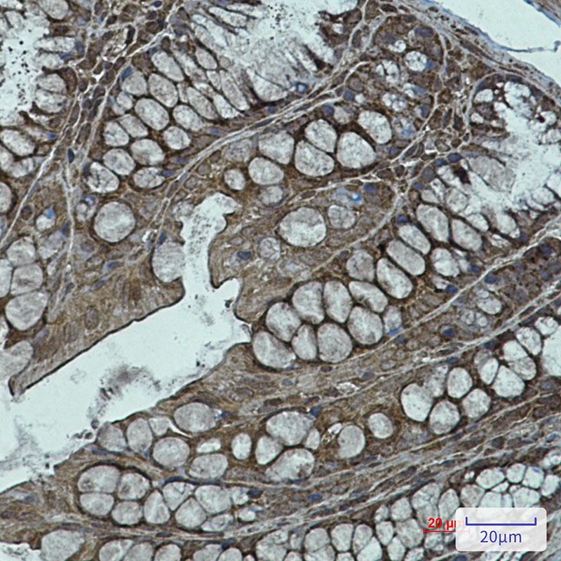 NDUFB11 Rabbit mAb