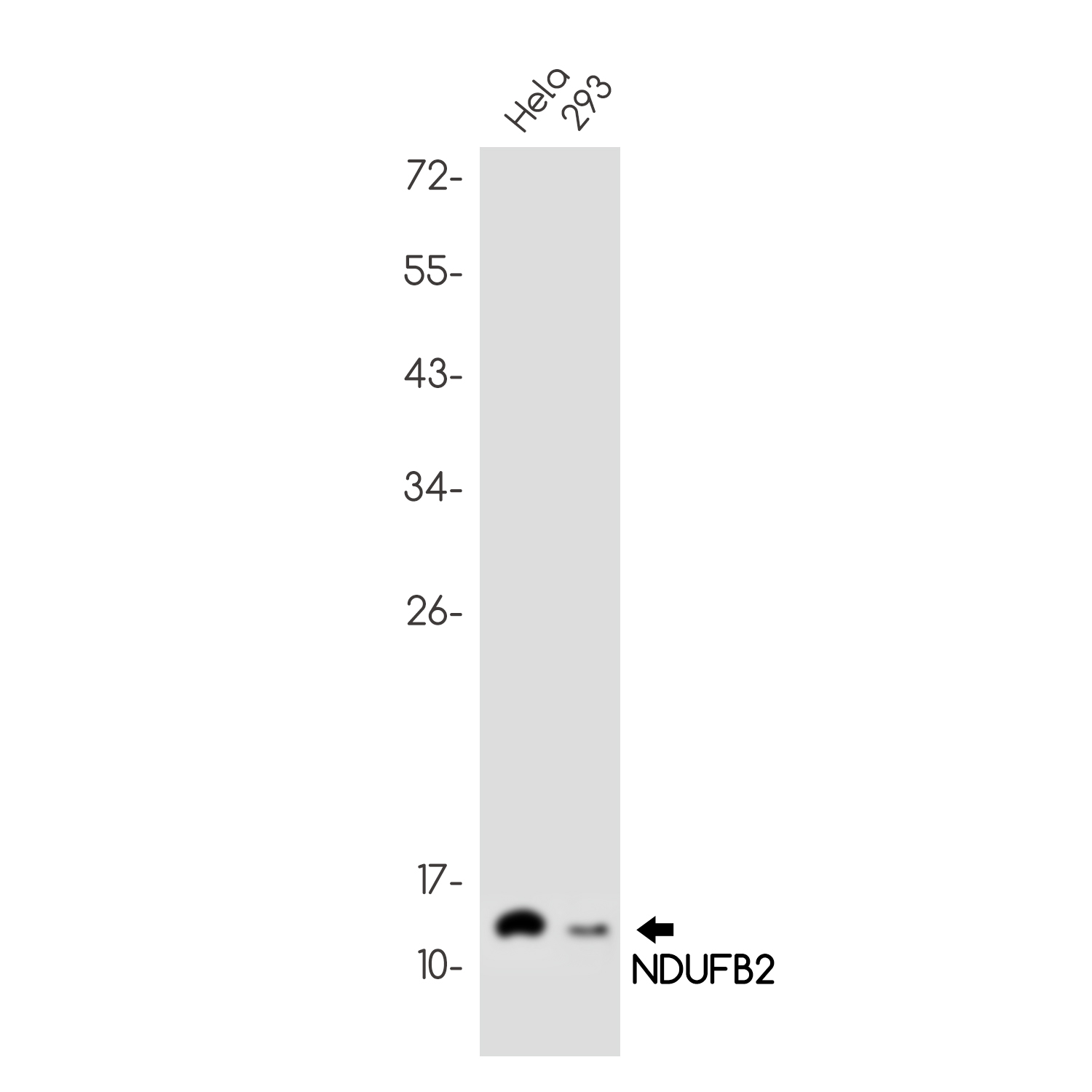 NDUFB2 Rabbit mAb