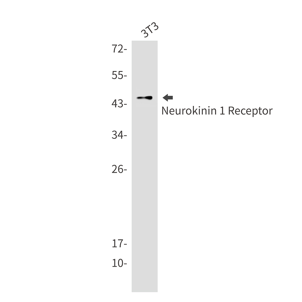 Neurokinin 1 Receptor Rabbit mAb
