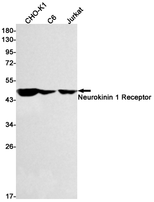 Neurokinin 1 Receptor Rabbit mAb