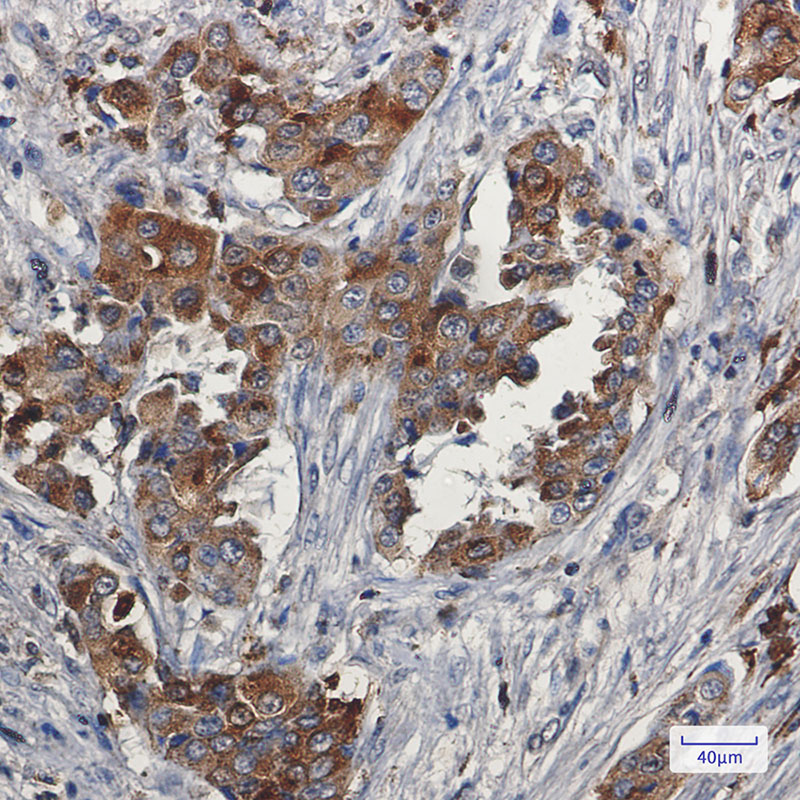 Niemann Pick C2 Rabbit mAb