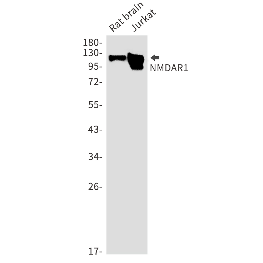 NMDAR1 Rabbit mAb