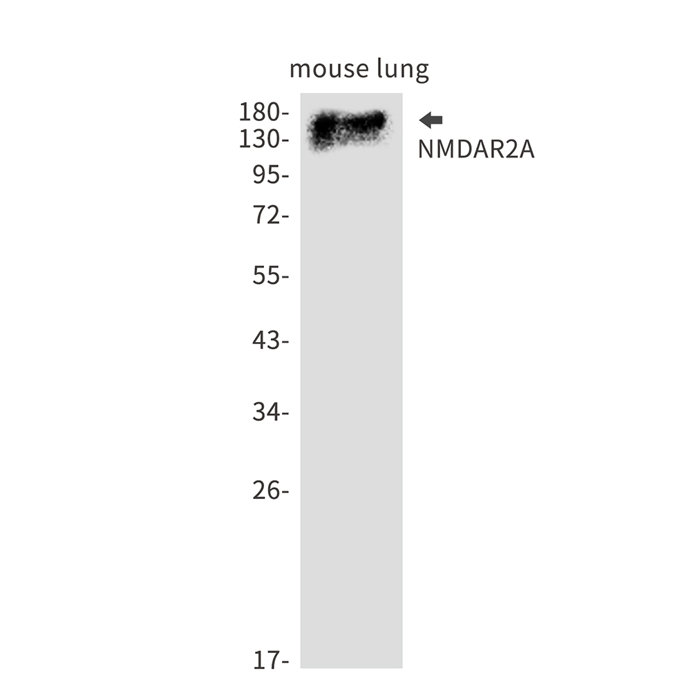 NMDAR2A Rabbit mAb
