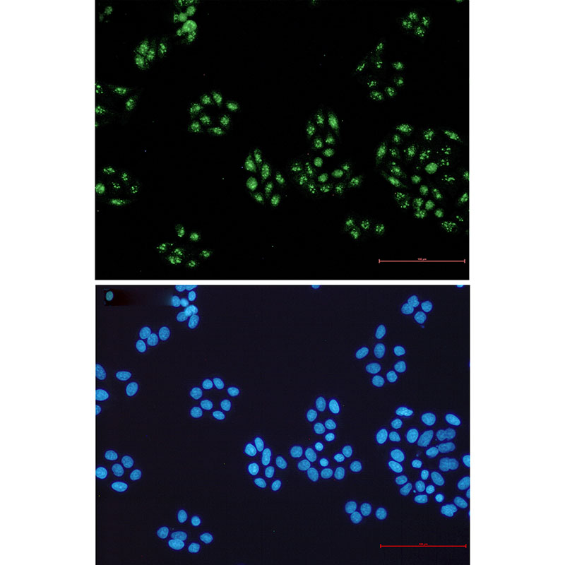 NOLC1 Rabbit mAb