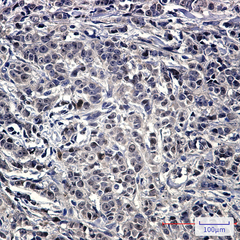 NOLC1 Rabbit mAb
