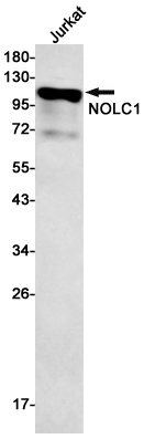 NOLC1 Rabbit mAb