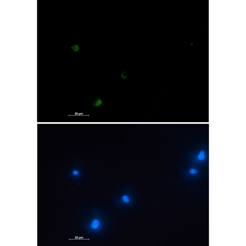 NUDT19 Rabbit mAb
