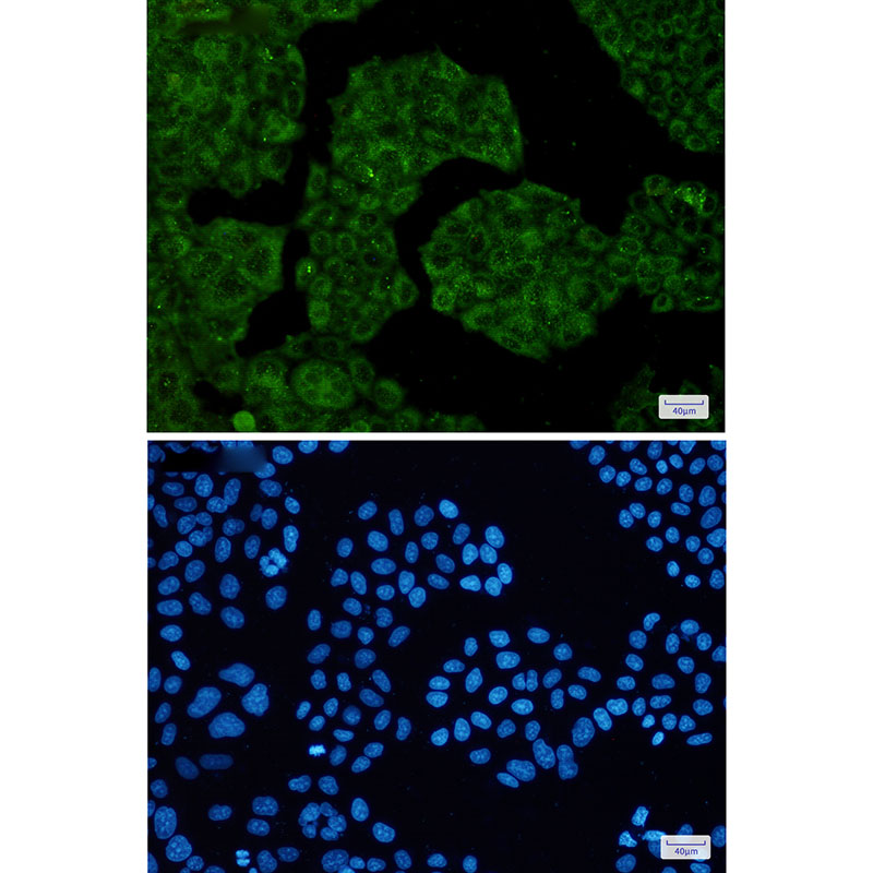 NUDT9 Rabbit mAb