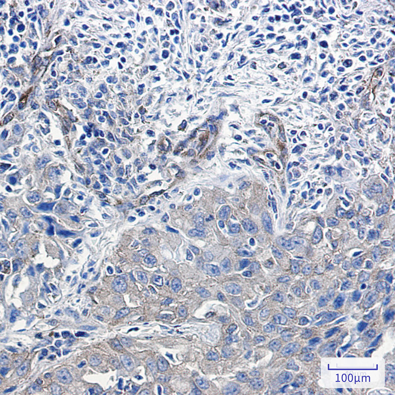 NUMB Rabbit mAb