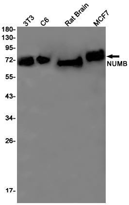 NUMB Rabbit mAb