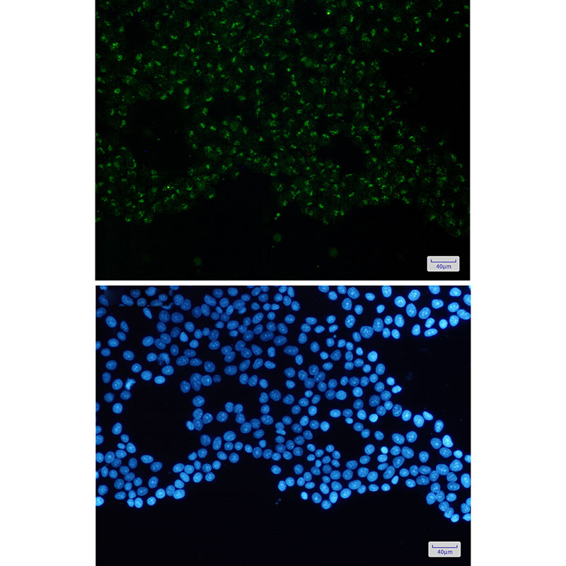 N WASP Rabbit mAb