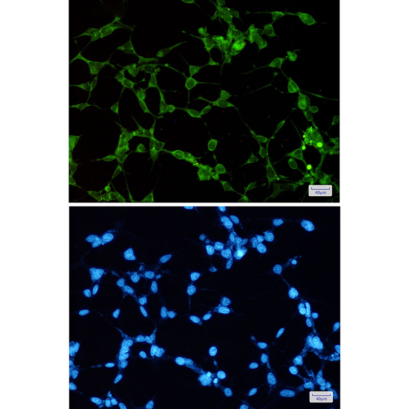 ORP1 Rabbit mAb