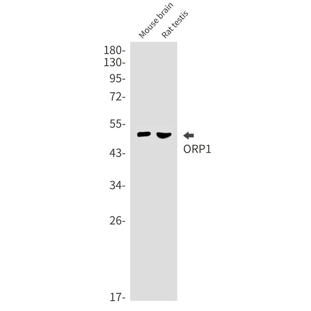 ORP1 Rabbit mAb