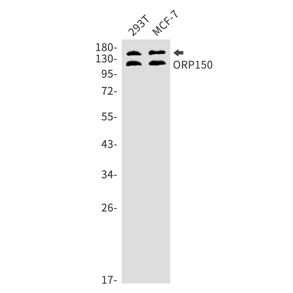 ORP150 Rabbit mAb