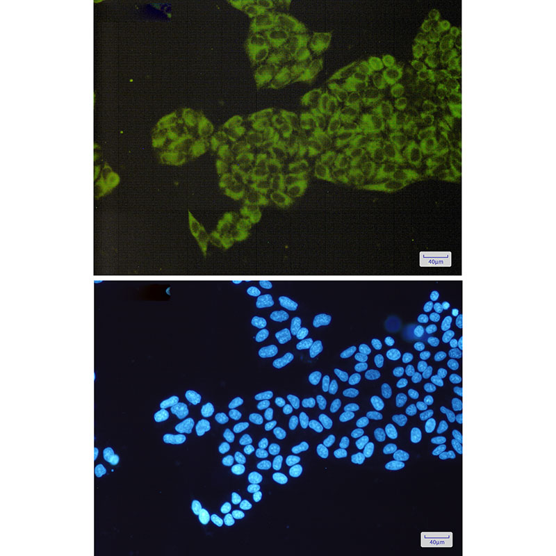 ORP150 Rabbit mAb