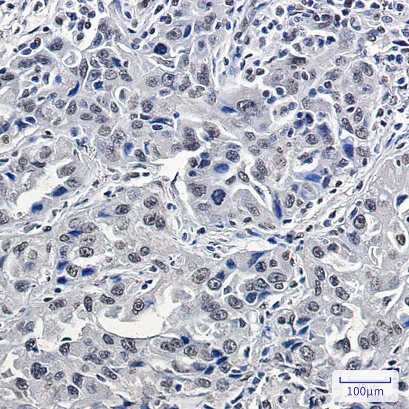 p150 CAF1 Rabbit mAb