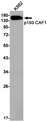 p150 CAF1 Rabbit mAb