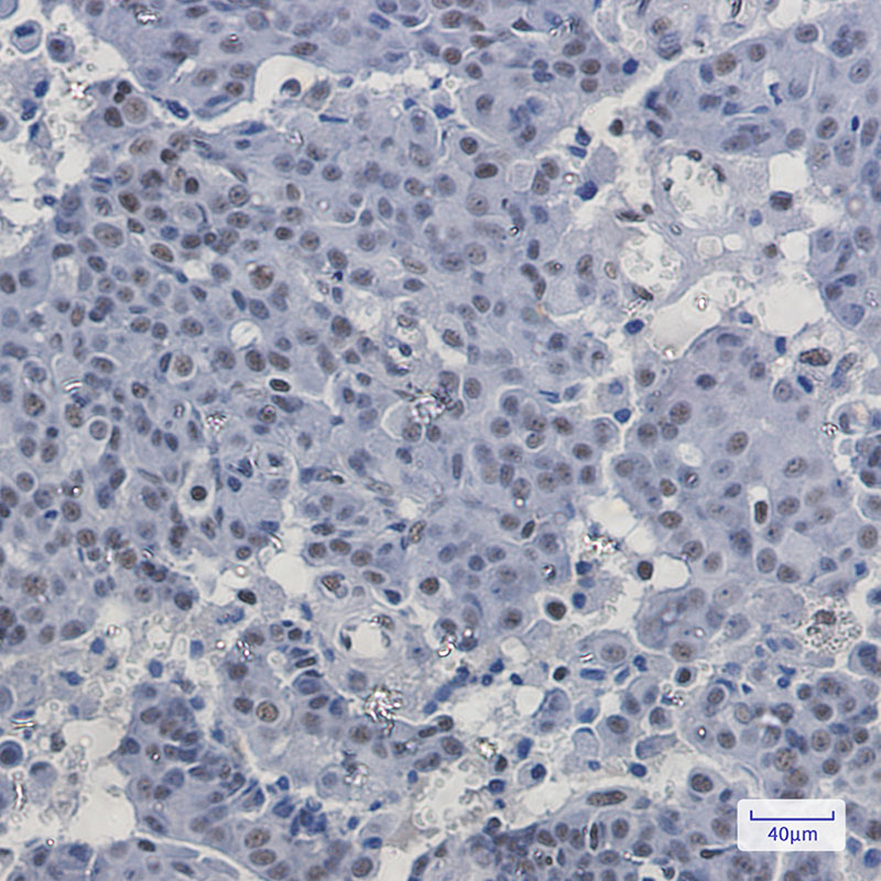 PABPN1 Rabbit mAb