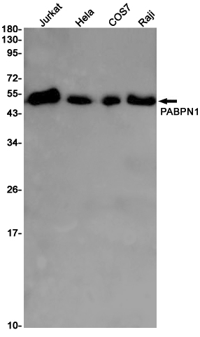 PABPN1 Rabbit mAb