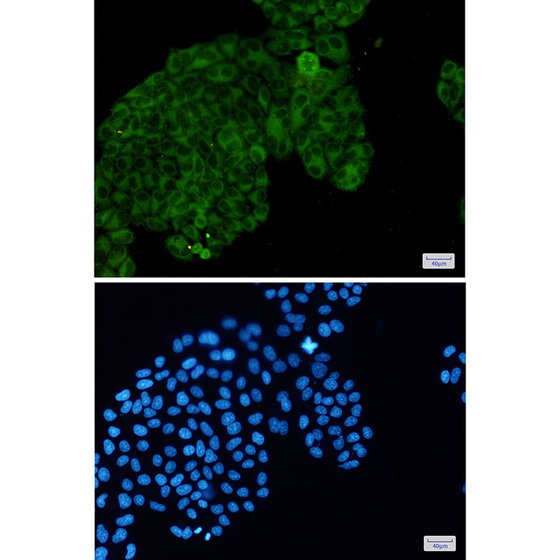 Phospho-PAK1/2/3 (Ser144/Ser141/Ser154) Rabbit mAb