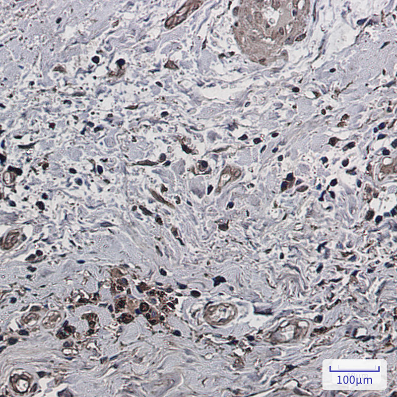 Phospho-PAK1/2/3 (Ser144/Ser141/Ser154) Rabbit mAb