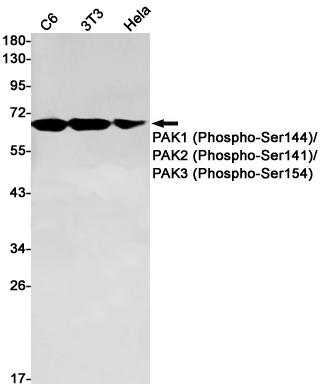Phospho-PAK1/2/3 (Ser144/Ser141/Ser154) Rabbit mAb