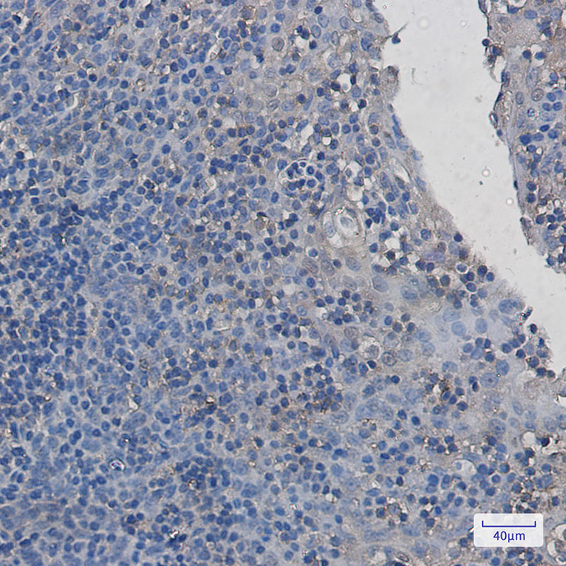 PAK2 Rabbit mAb