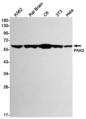 PAK2 Rabbit mAb