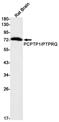 PCPTP1 Rabbit mAb
