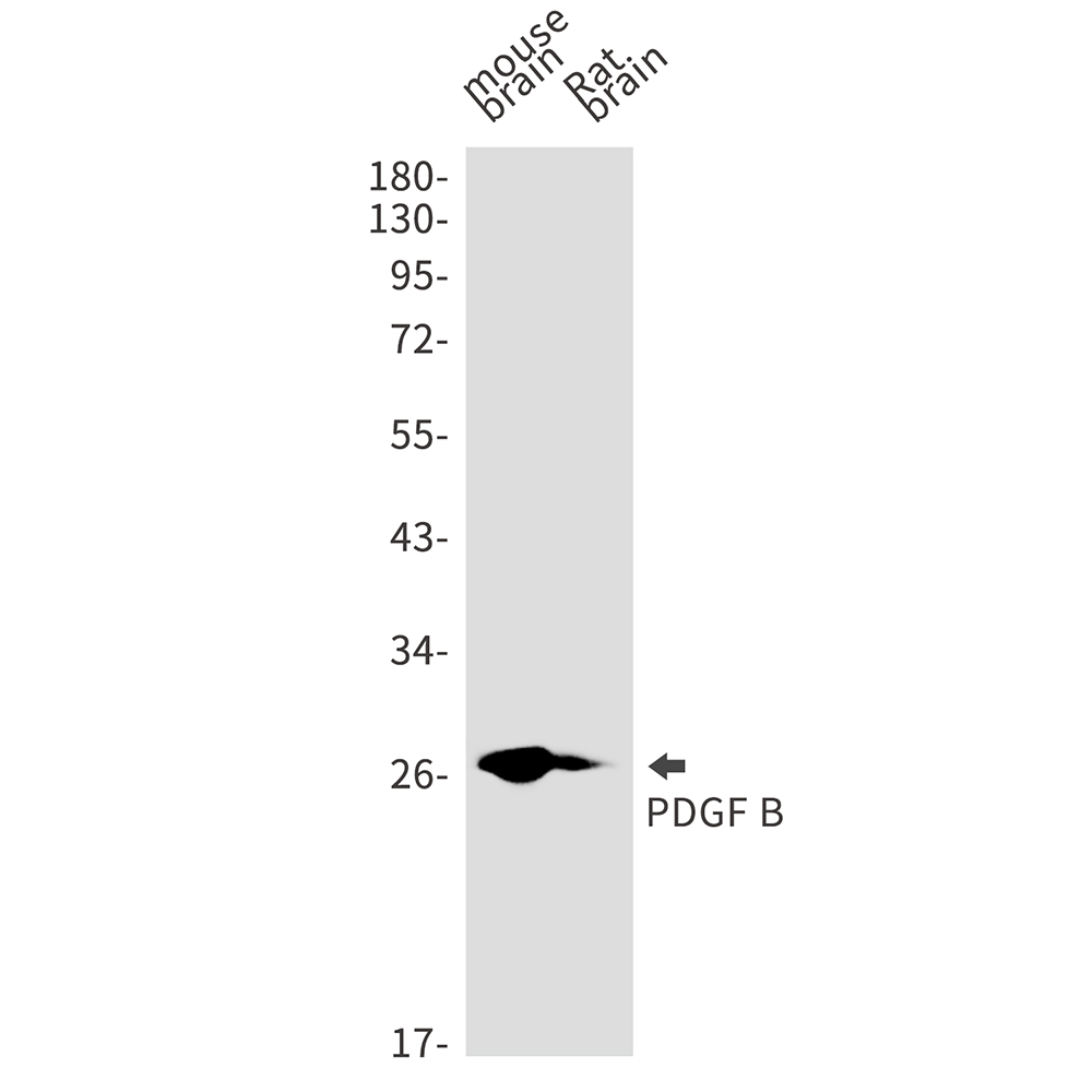PDGF B Rabbit mAb