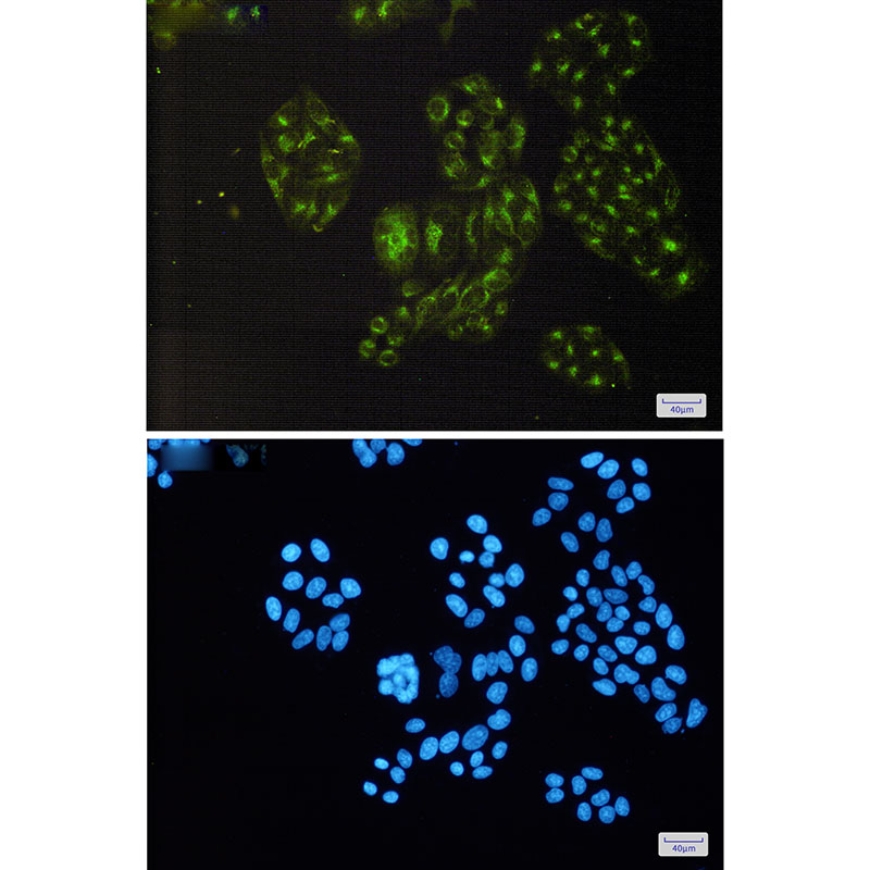 PDLIM1 Rabbit mAb