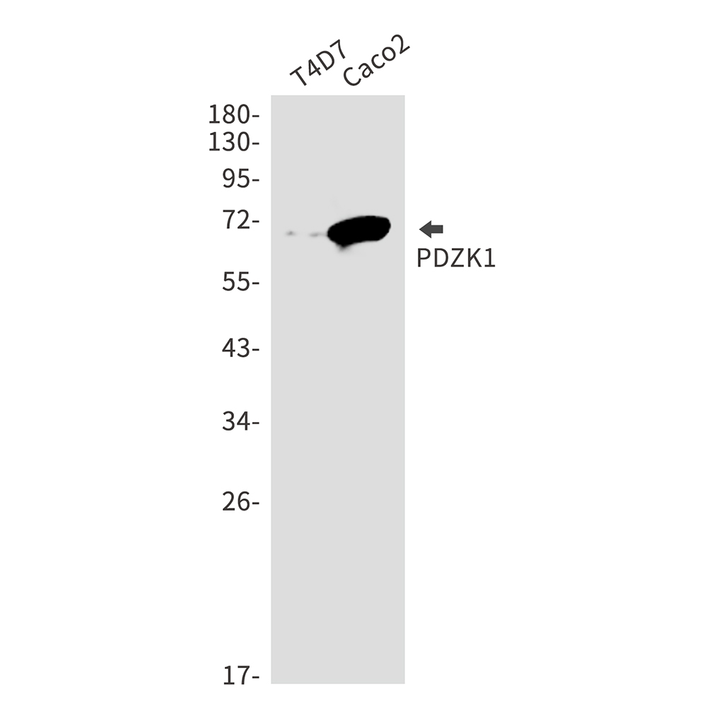 PDZK1 Rabbit mAb