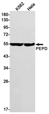 PEPD Rabbit mAb
