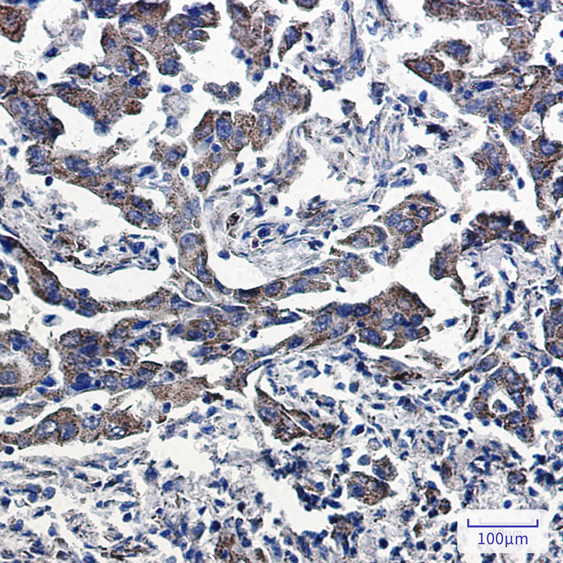 Peroxiredoxin 5 Rabbit mAb